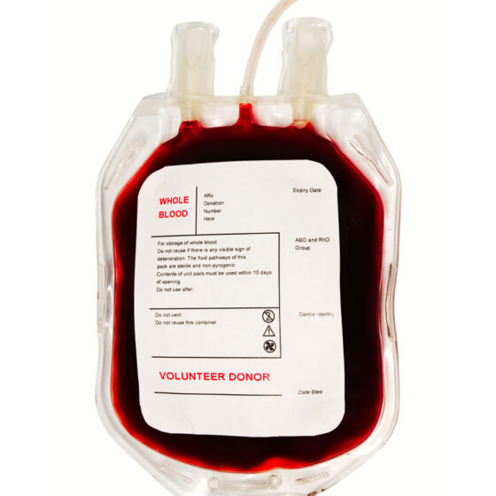 Blood bag label